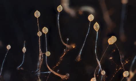  Dictyostelium Discoideum: Une créature fascinante qui danse entre la liberté unicellulaire et la collaboration sociale!