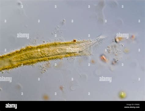  Burrowing Ciliate: Une Créature Fascinante Qui S'Enfonce Dans Le Sol Avec Grâce !