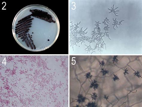  Janthinobacterium: Un Champion de la Décomposition Microbienne et Maître du Camouflage!